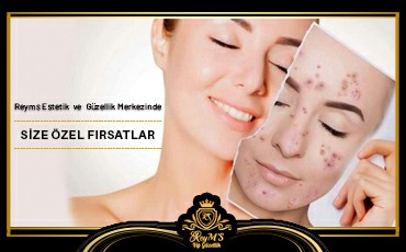 Samsun Güzellik Salonları